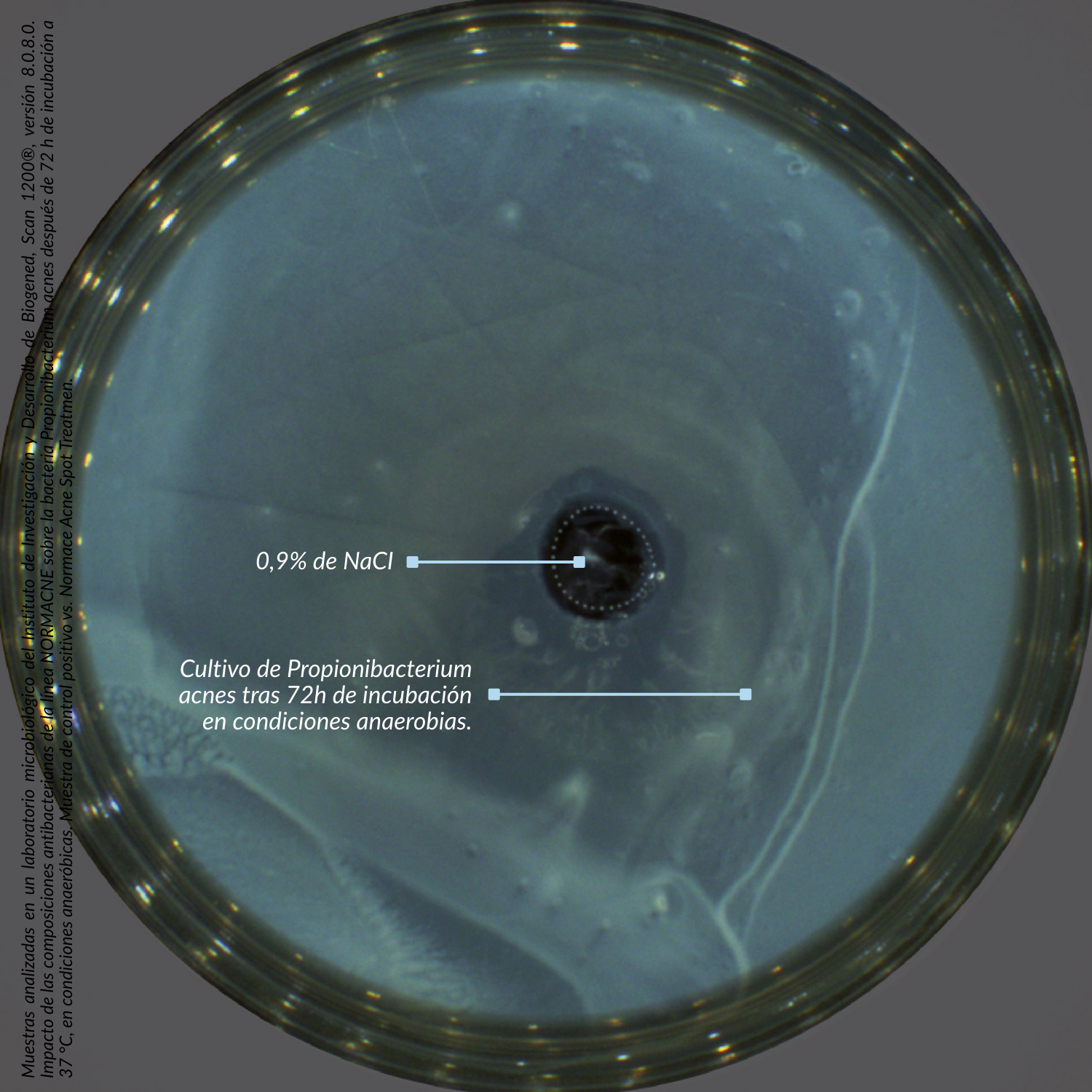 Corrector de Imperfecciones Localizadas - NORMACNE | Dermedic - Imagen 6