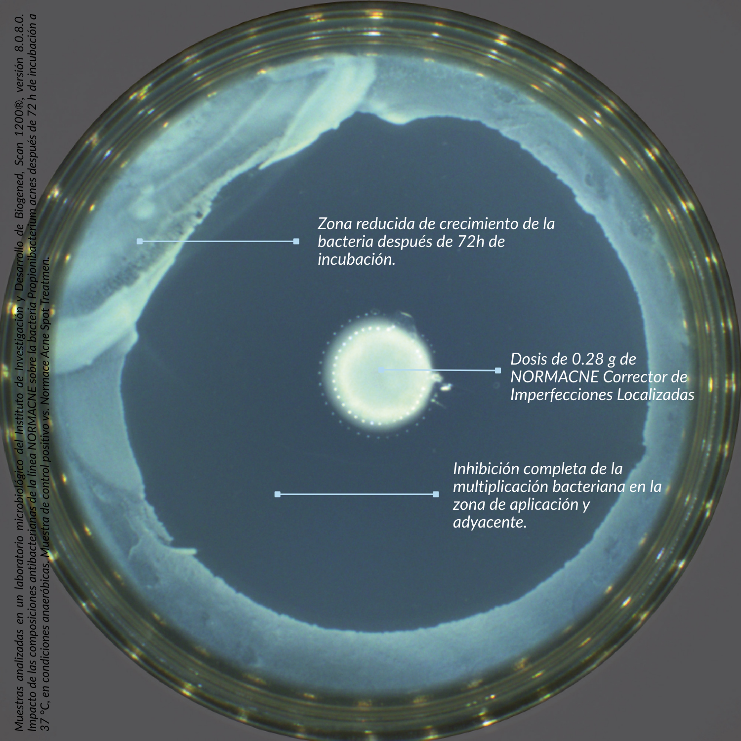 Corrector de Imperfecciones Localizadas - NORMACNE | Dermedic - Imagen 7
