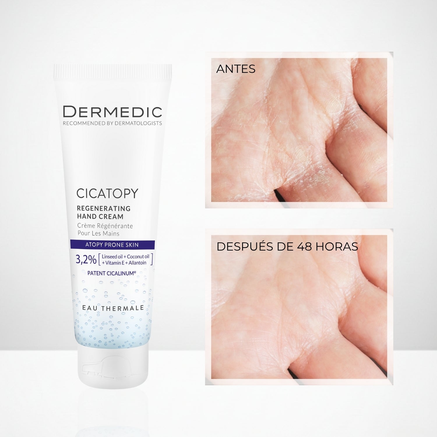 Crema Regeneradora de Manos - CICATOPY | Dermedic - Imagen 3