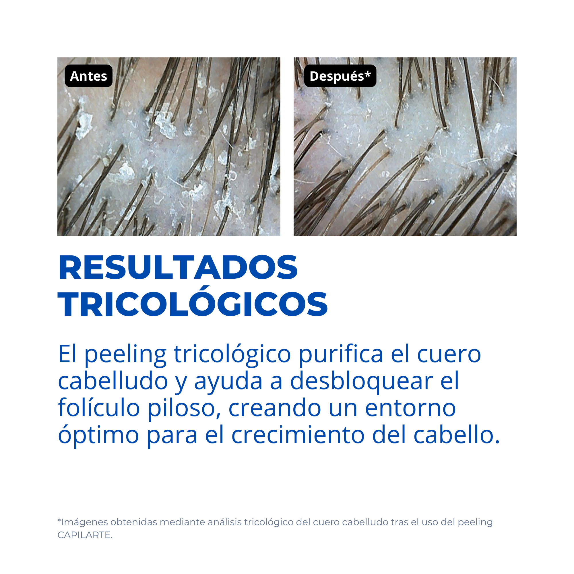 Kit Esencial Densidad Capilar